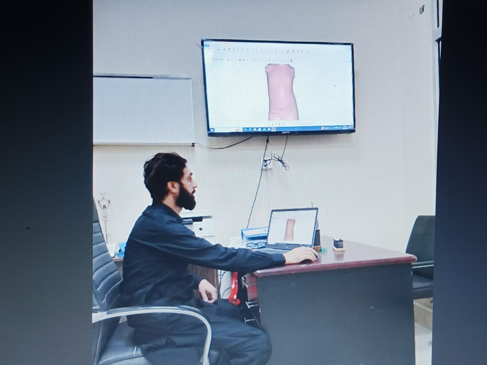Digital model of a patient-specific device reviewed on screen
