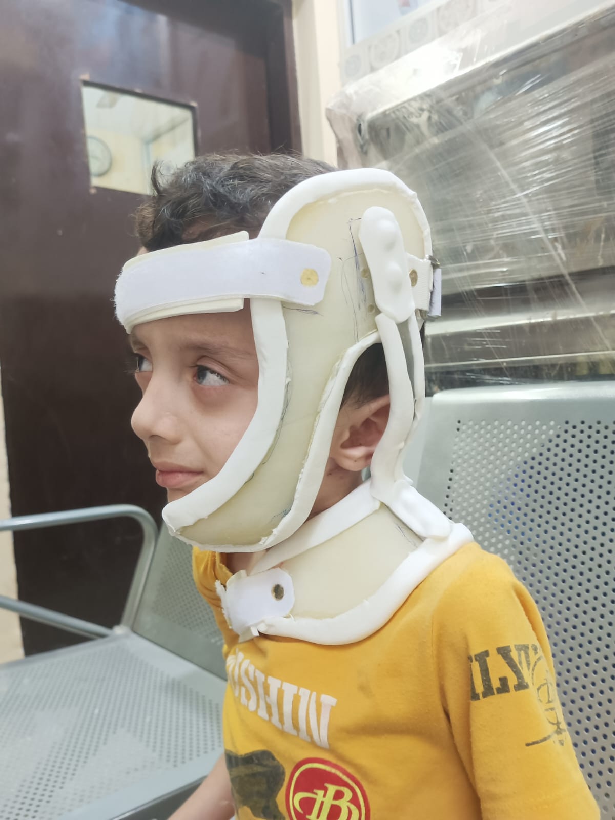 Custom cervical and head orthosis fitted for a young patient