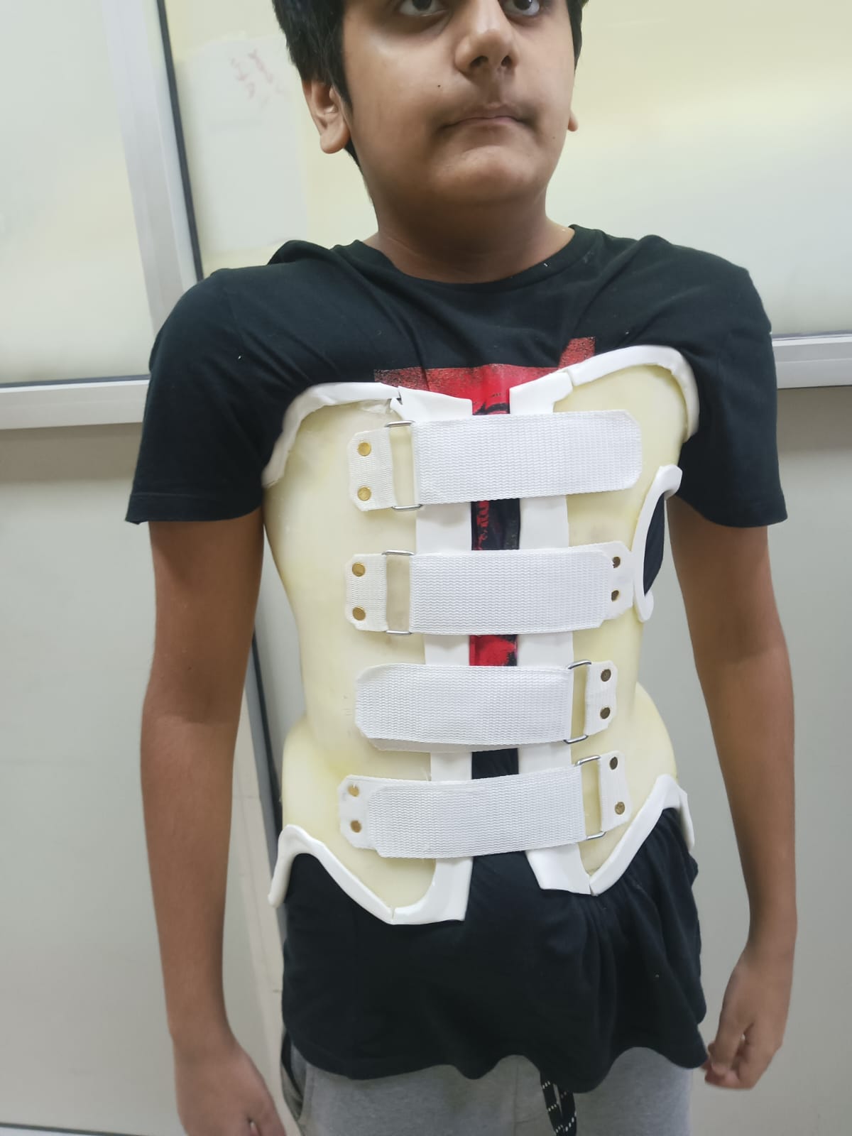 Custom orthotic device being shaped in the Ortho Care Home workshop